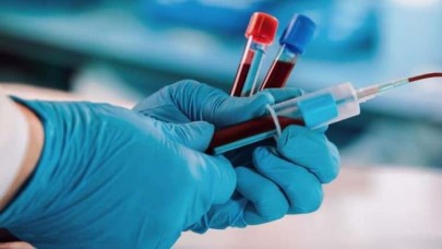 Kan grubuna göre ne kadar zekisin? İşte en yükse IQ'ya sahip kan grubu...