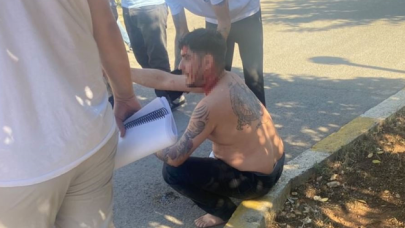 Dizi setine silahlı saldırı! Cengo rolüyle tanınan oyuncu  başından yaralandı