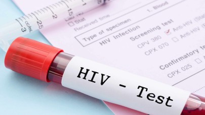 HIV Testi ile Bulaşıcı Hastalıklara Son
