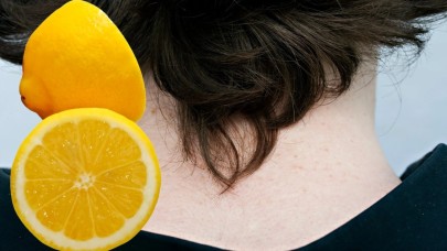 Enseye her gece limon sürüp yatarsanız o derdiniz bitecek