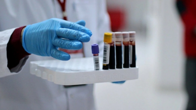 En çok yaşayan kan grubu belli oldu!