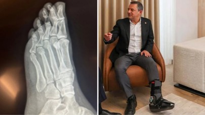 Özgür Özel'den "Vuruldu" iddialarına sert tepki!