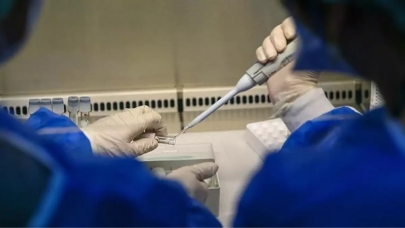 İskenderun'da 'Maymun Çiçeği' vakası iddiaları infiale neden oldu: Açıklama geldi!