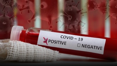 Covid ile kalp 3 yıl tehlikede: İşte riski en az olan kan grubu