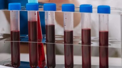 Bu kan grubuna hastalık uğramıyor: En sağlıklı kan grubu buymuş..
