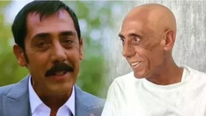 Doktorlar duyurdu: Ankaralı Turgut'tan müjdeli haber