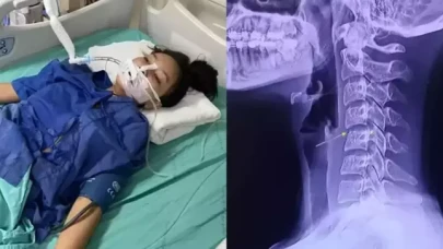 Trajik masaj olayı: Boyun ağrısıyla başladı,  hayatını kaybetti