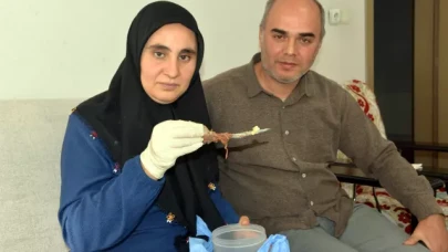 Şok eden olay: Baş ağrısıyla gitti,  karnından 16 cm makas çıktı