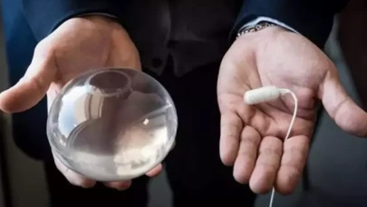 Sağlık Bakanlığı’ndan mide balonu sistemi için tedbir kararı!