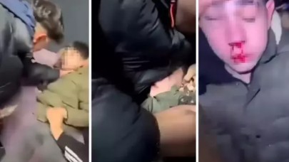 Sağır ve dilsiz çocuğa işkence! Dövüp kulağını kestiler..