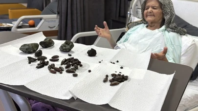 Yuttuğu zeytin ve hurma çekirdekleri başına iş açtı!