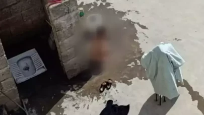 Çocuklara işkence eden Baba ve üvey anne gözaltına alındı!