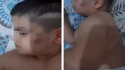 Bursa'da otizm hastası çocuğa öğretmeninden darp iddiası