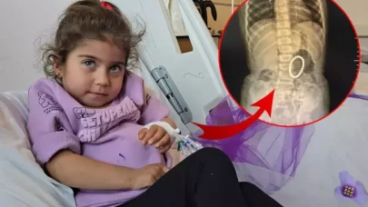 4 yaşındaki çocuğun bağırsaklarından çıkanlar şoke etti