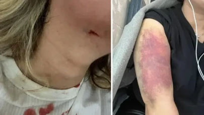 Eski sevgilisi kapıyı kırıp boğazını sıkarak darbetti,  d.ehşeti saniye saniye kaydetti