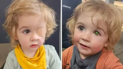 2 yaşındaki çocuk bir öpücük yüzünden gözünü kaybetti
