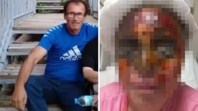 "Babam yaşındasın" deyip reddettiği adam yüzüne kezzap attı!