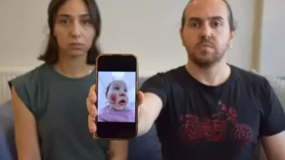 2 yaşındaki bebeğe kreşte dayak,  yüzü parçalanmış!