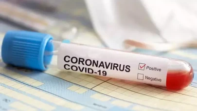 Pandeminin parlayan yıldızıydı: Dev firma konkordato ilan etti