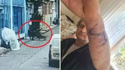 Bursa’da pitbull saldırısı davasında 21 yıl hapis talebi