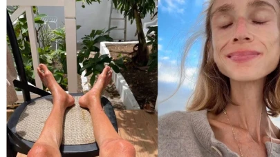 22 kiloya kadar düşmüştü! Sosyal medya fenomeni kaldığı otelde hayatını kaybetti