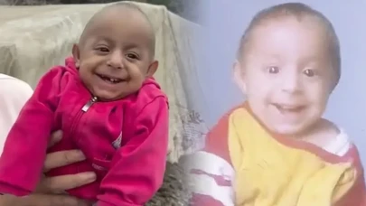 Sosyal medyada 'Gülen Bebek' olarak tanınan Ökkeş bebek yaşamını yitirdi