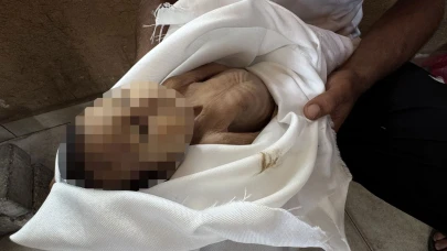 DSÖ: Gazze’de yetersiz beslenmeye bağlı 400 ölüm doğrulandı