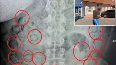 Aksaray'da pes dedirten olay! Midesinden 433 gram metamfetamin çıktı