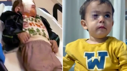 Bursa’da torpil faciası: 2 yaşındaki çocuk gözünü kaybetti