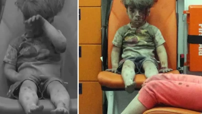 Dünya gündemine oturan Ümran bebeğin son hali.. Yürekleri burktu