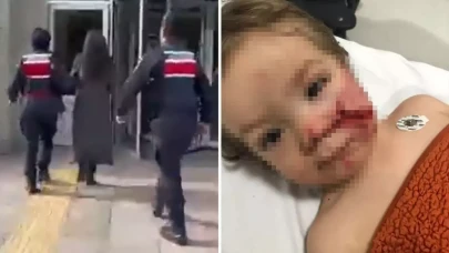 Ankara’da iki küçük kardeşe saldıran pitbull ve sahibi tutuklandı