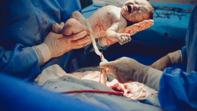 Hastanelerde yeni dönem: Sağlık Bakanlığı'dan sezaryen doğum kararı