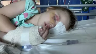 Çamaşır deterjanı kapsülünü ısıran 4 yaşındaki kız kör oldu