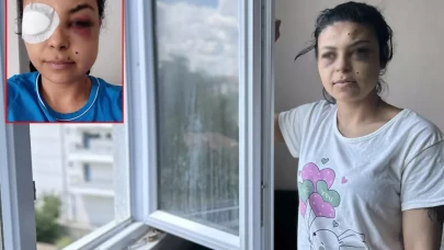 Pencereden düğünü seyrederken gözünden vuruldu: Hayatım bitti