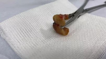 Dayanılmaz öksürükle uyanan adam aynaya bakınca şok oldu