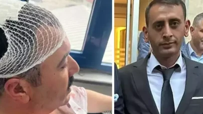 Belediye Başkan Yardımcısı'na şekerlikle saldıran Yeniden Refah Partili tutuklandı