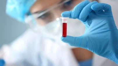 Yeni bir kan grubu keşfedildi