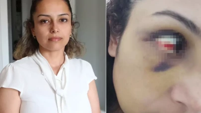 Öğretmen Burcu Kara'nın çığlığı yürek dağladı