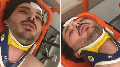 Ünlü oyuncu, trafikte öldüresiye dövüldü