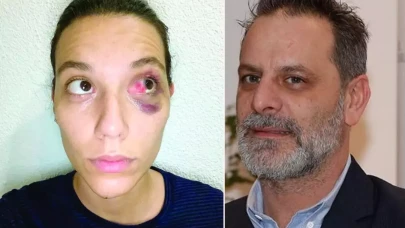 Ozan Güven'e şok ceza! Eski sevgilisini darp ettiği için hapis yatacak mı?