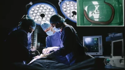 Karın ağrısı şikayetiyle hastaneye giden adamın karnından canlı yılan balığı çıktı