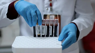 A Rh+ kan grubuna sahip olanlar dikkat!