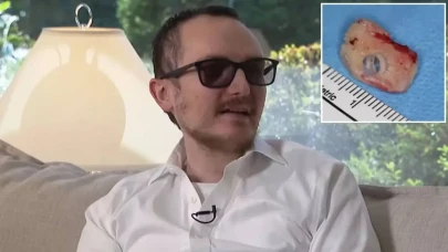 20 yıllık körlüğe son! Kendi dişi gözüne takıldı, görmeye başladı