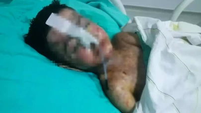 Salatalık yutunca rahatsızlandı: Korkunç gerçek röntgende ortaya çıktı