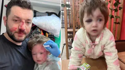 Komşu kavgası faciaya dönüştü: 14 aylık bebek ağır yaralandı