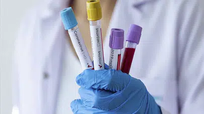 Hepatit D tedavisinde önemli gelişme: İlk kez Çin'de uygulandı