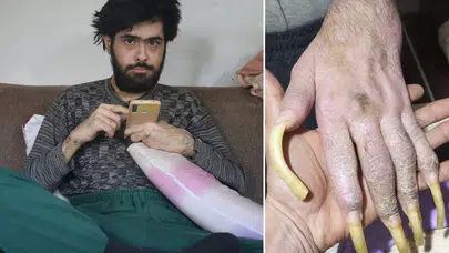 Türkiye'nin konuştuğu Barış'ın son hali! 25 yaşını kutladı, türkü bile söyledi