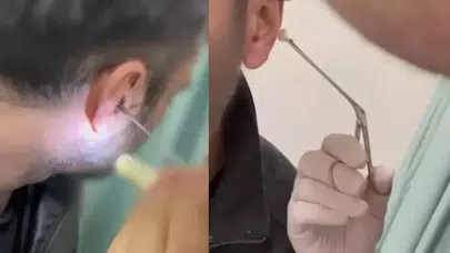 Kayseri’de uyuşturucu operasyonu: Kulağına gizlediği uyuşturucuyla yakalandı