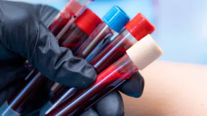 Bütün gün uyukluyorlar: En yorgun kan grubu belli oldu!