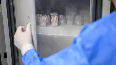 İnsanların derileri Türkiye’de bu merkezde saklanıyor